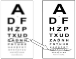 Improvement simulation of Visual Acuity