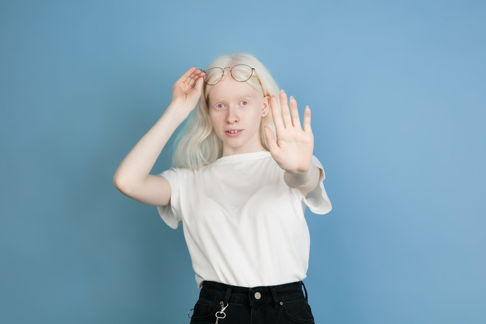 beautiful albino girl